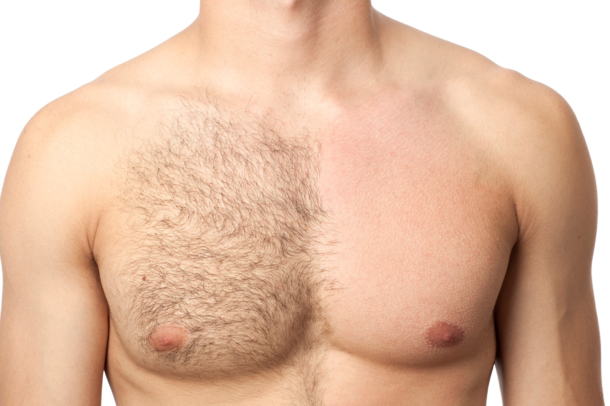 man chest hair shaved before and after